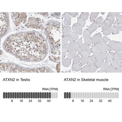 Ataxin-2 Antibody, Novus Biologicals:Antibodies:Primary Antibodies